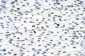 ADAT1 antibody - C-terminal region